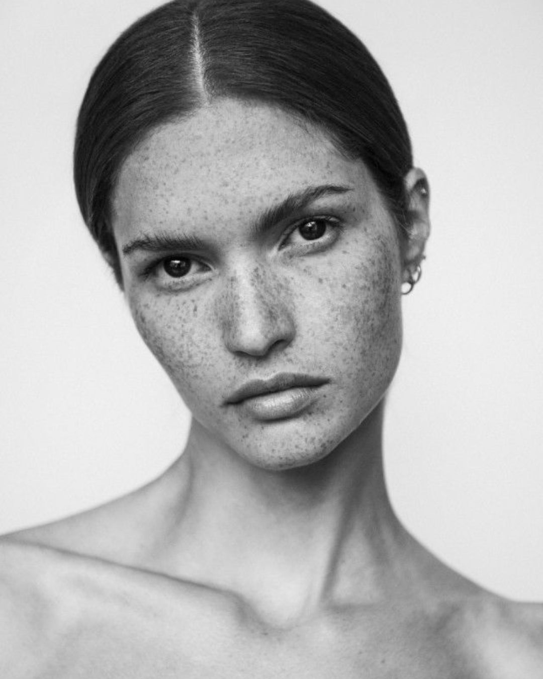 Armonización facial en Madrid: Qué es, beneficios y precios detallados