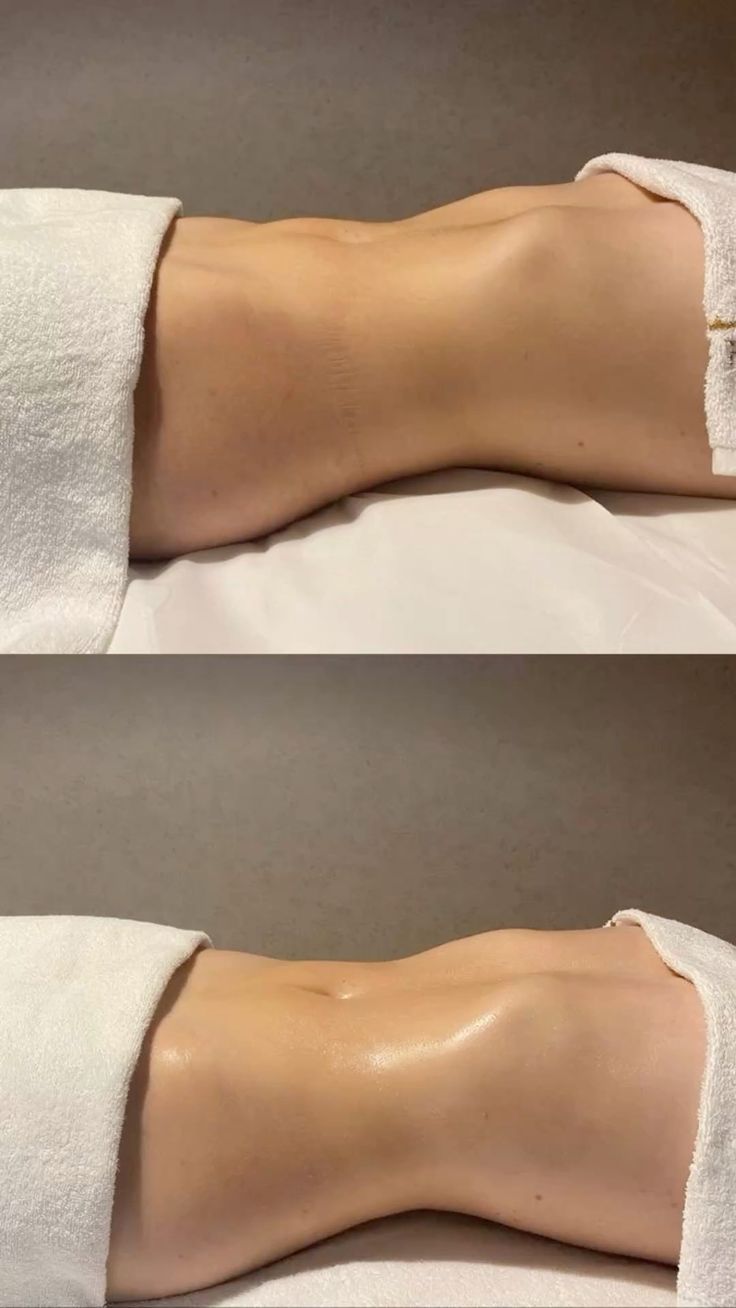 Presoterapia: Resultados visibles y plan de sesiones para una figura ligera.