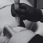 Carte cadeau Dermapen pour le visage