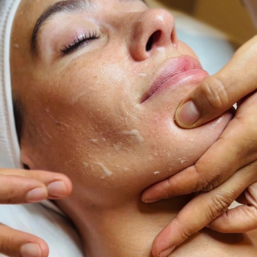 Green peel de Dr Schrammek