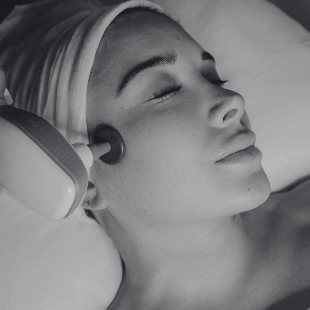 Indiba instant beauty