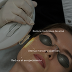 Tarjeta Regalo ipl anti imperfecciones