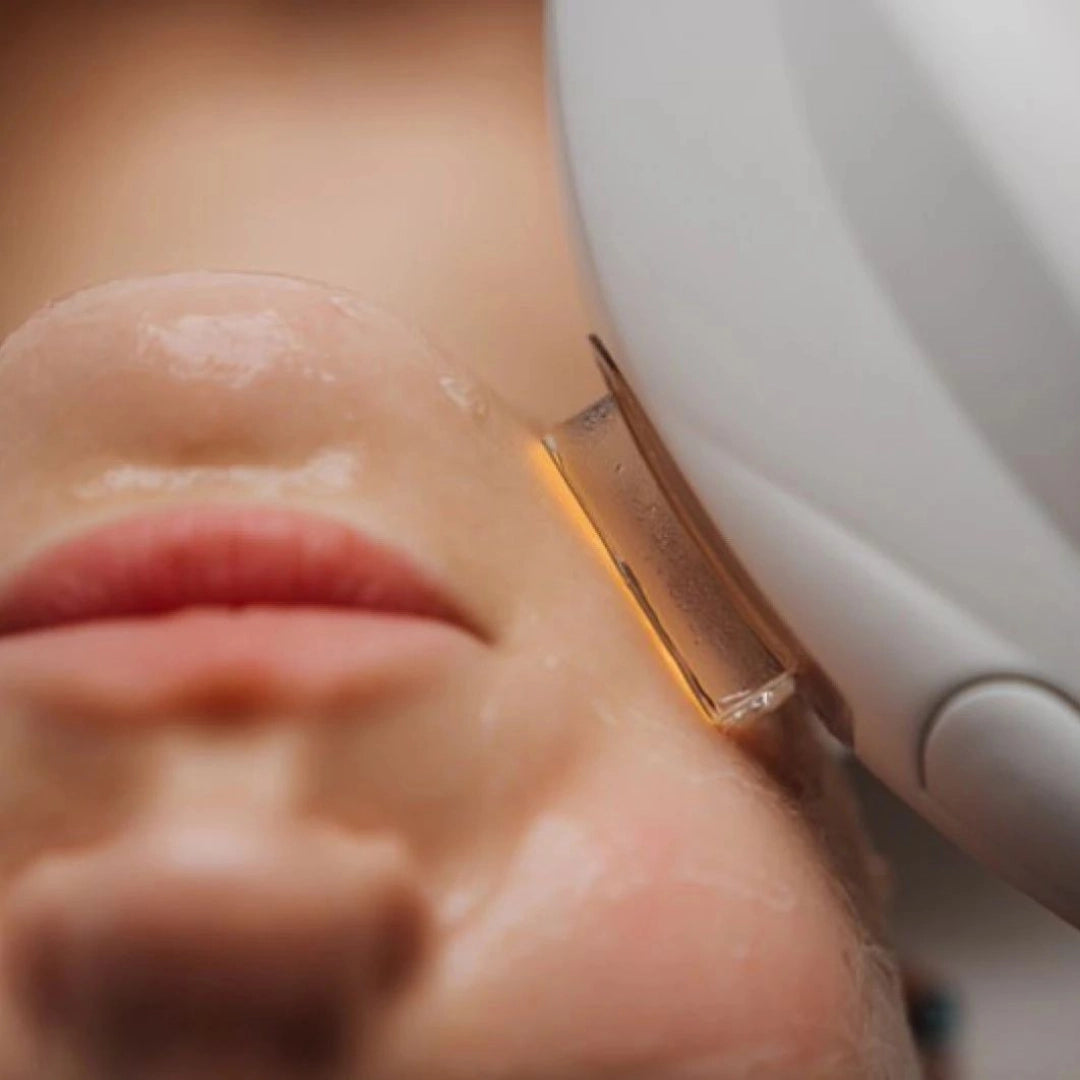IPL Rejuvenation Treatment Gift Card