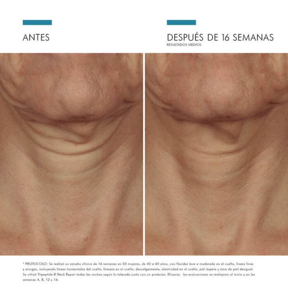 Tripeptide-R Neck Repair