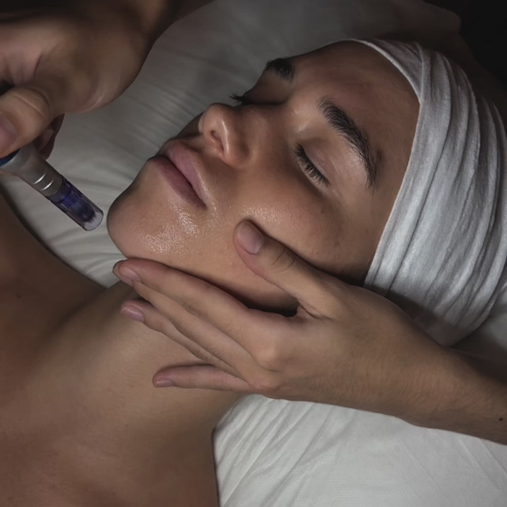 Carte cadeau Dermapen pour le visage