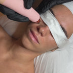 Carte cadeau microdermabrasion