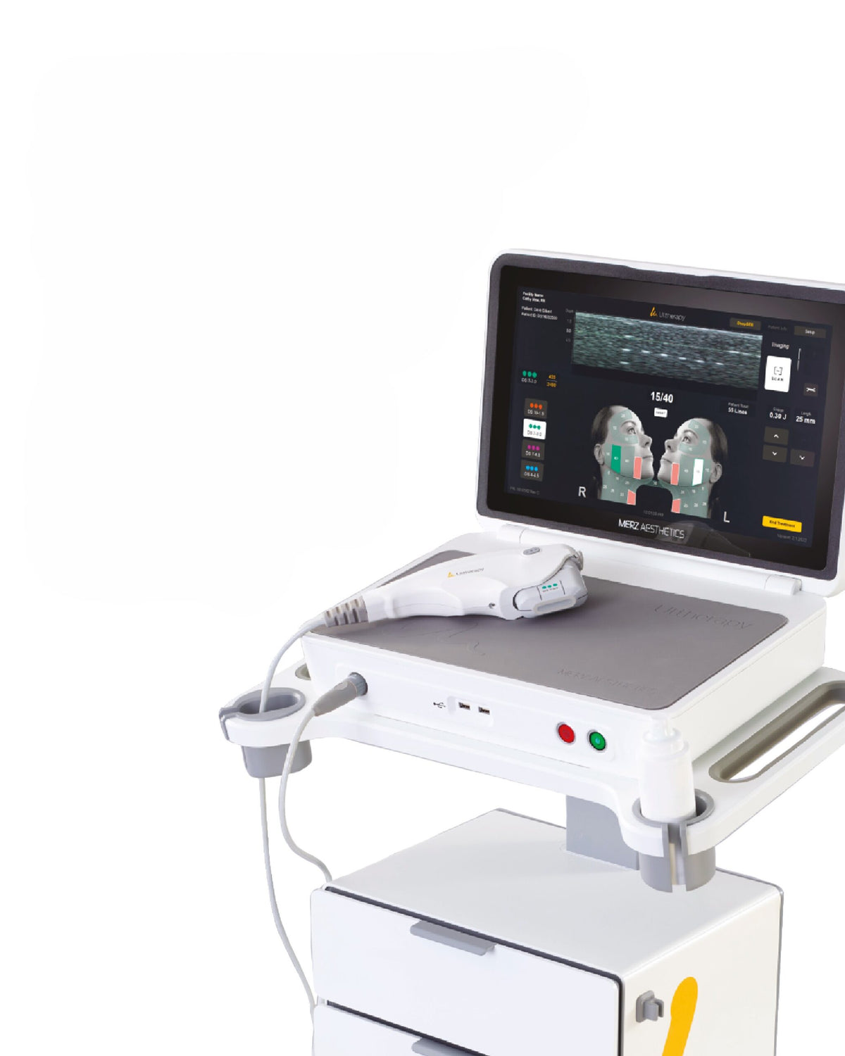 Ultherapy Prime Zona Periocular